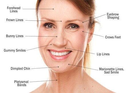 Where botox can help with available at Dr Azoo Clinic in Ealing London