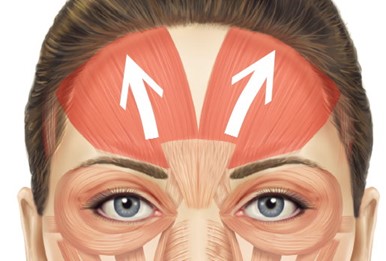 Diagram of the frontalis muscle, the only muscle that lifts the brow